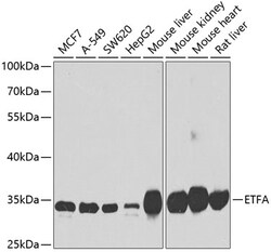 Invitrogen ETFA Polyclonal Antibody 100 &mu;L; Unconjugated:Antibodies,