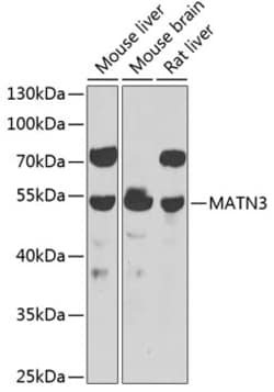 Invitrogen MATN3 Polyclonal Antibody 100 &mu;L; Unconjugated:Antibodies,