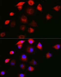 Invitrogen SHC Polyclonal Antibody 100 &mu;L; Unconjugated:Antibodies,