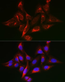Invitrogen SHC Polyclonal Antibody 100 &mu;L; Unconjugated:Antibodies,