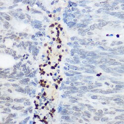 Invitrogen SHC Polyclonal Antibody 100 &mu;L; Unconjugated:Antibodies,
