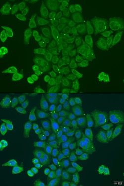 Invitrogen DPM1 Polyclonal Antibody 100 &mu;L; Unconjugated:Antibodies,