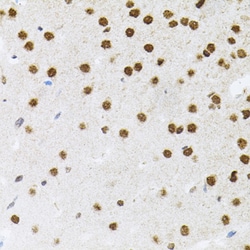 Invitrogen FAF1 Polyclonal Antibody 100 &mu;L; Unconjugated:Antibodies,