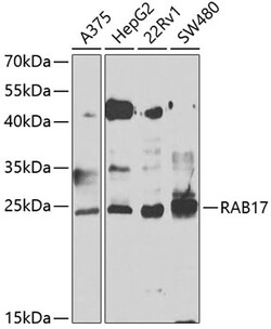 Invitrogen RAB17 Polyclonal Antibody 100 &mu;L; Unconjugated:Antibodies,