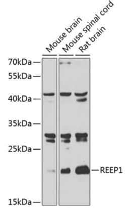 Invitrogen REEP1 Polyclonal Antibody 100 &mu;L; Unconjugated:Antibodies,