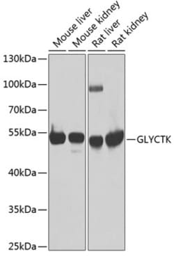 Invitrogen GLYCTK Polyclonal Antibody 100 &mu;L | Buy Online | Invitrogen&trade; | Fisher Scientific