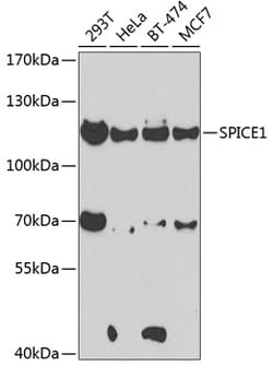 Invitrogen SPICE1 Polyclonal Antibody 100 μL; Unconjugated:Antibodies,