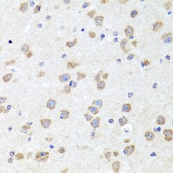 Invitrogen CHD1 Polyclonal Antibody 100 &mu;L | Buy Online | Invitrogen&trade; | Fisher Scientific