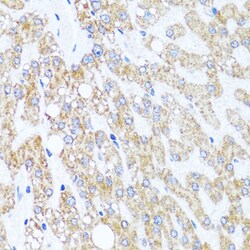 Invitrogen CHD1 Polyclonal Antibody 100 &mu;L | Buy Online | Invitrogen&trade; | Fisher Scientific
