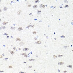 Invitrogen CHD1 Polyclonal Antibody 100 &mu;L | Buy Online | Invitrogen&trade; | Fisher Scientific