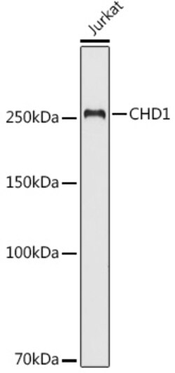 Invitrogen CHD1 Polyclonal Antibody 100 &mu;L | Buy Online | Invitrogen&trade; | Fisher Scientific