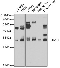 Invitrogen eIF2b alpha Polyclonal Antibody 100 &mu;L; Unconjugated:Antibodies,