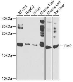 Invitrogen LIM2 Polyclonal Antibody 100 &mu;L; Unconjugated:Antibodies,