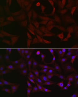 Invitrogen PFKP Polyclonal Antibody 100 &mu;L; Unconjugated:Antibodies,