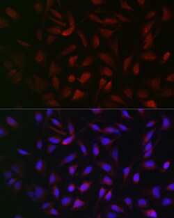 Invitrogen PFKP Polyclonal Antibody 100 &mu;L; Unconjugated:Antibodies,