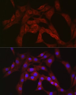 Invitrogen PFKP Polyclonal Antibody 100 &mu;L; Unconjugated:Antibodies,