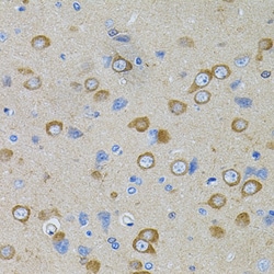 Invitrogen PFKP Polyclonal Antibody 100 &mu;L; Unconjugated:Antibodies,