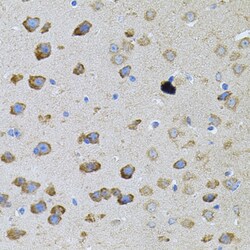 Invitrogen PFKP Polyclonal Antibody 100 &mu;L; Unconjugated:Antibodies,
