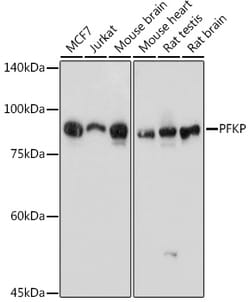 Invitrogen PFKP Polyclonal Antibody 100 &mu;L; Unconjugated:Antibodies,