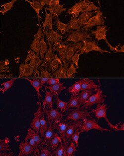 Invitrogen ADAM12 Polyclonal Antibody 100 &mu;L; Unconjugated:Antibodies,