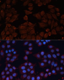 Invitrogen ADAM12 Polyclonal Antibody 100 &mu;L; Unconjugated:Antibodies,
