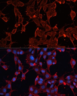 Invitrogen ADAM12 Polyclonal Antibody 100 &mu;L; Unconjugated:Antibodies,
