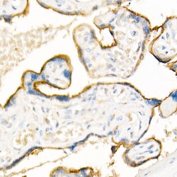 Invitrogen ADAM12 Polyclonal Antibody 100 &mu;L; Unconjugated:Antibodies,