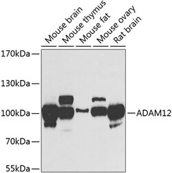Invitrogen ADAM12 Polyclonal Antibody 100 &mu;L; Unconjugated:Antibodies,