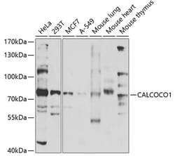 Invitrogen CALCOCO1 Polyclonal Antibody 100 &mu;L; Unconjugated:Antibodies,