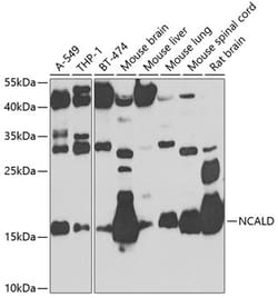 Invitrogen NCALD Polyclonal Antibody 100 &mu;L; Unconjugated:Antibodies,