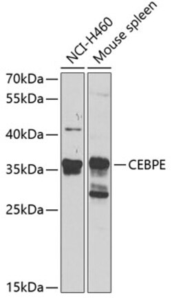Invitrogen C/EBP epsilon Polyclonal Antibody 100 &mu;L; Unconjugated:Antibodies,