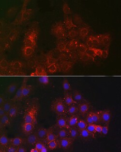 Invitrogen TROP2 Polyclonal Antibody 100 &mu;L; Unconjugated:Antibodies,