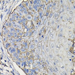 Invitrogen TROP2 Polyclonal Antibody 100 &mu;L; Unconjugated:Antibodies,