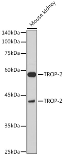 Invitrogen TROP2 Polyclonal Antibody 100 &mu;L; Unconjugated:Antibodies,