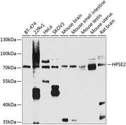 Invitrogen HPa2 Polyclonal Antibody 100 &mu;L; Unconjugated:Antibodies,