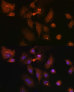 Invitrogen RSPO1 Polyclonal Antibody 100 μL; Unconjugated:Antibodies,