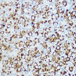 Invitrogen RSPO1 Polyclonal Antibody 100 μL; Unconjugated:Antibodies,