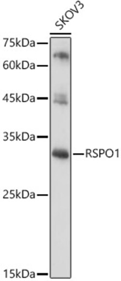 Invitrogen RSPO1 Polyclonal Antibody 100 μL; Unconjugated:Antibodies,