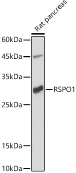 Invitrogen RSPO1 Polyclonal Antibody 100 μL; Unconjugated:Antibodies,