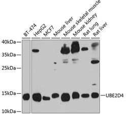 Invitrogen UBE2D4 Polyclonal Antibody 100 &mu;L; Unconjugated:Antibodies,
