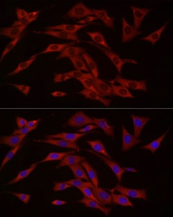 Invitrogen cGAS Polyclonal Antibody 100 μL; Unconjugated:Antibodies,