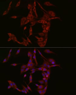 Invitrogen cGAS Polyclonal Antibody 100 μL; Unconjugated:Antibodies,