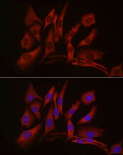Invitrogen cGAS Polyclonal Antibody 100 μL; Unconjugated:Antibodies,
