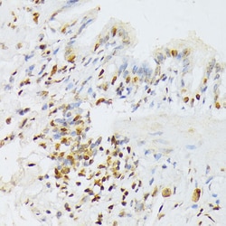 Invitrogen ANR52 Polyclonal Antibody 100 &mu;L; Unconjugated:Antibodies,