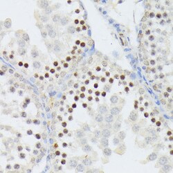 Invitrogen ANR52 Polyclonal Antibody 100 &mu;L; Unconjugated:Antibodies,
