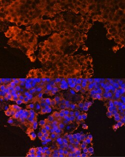 Invitrogen GHRHR Polyclonal Antibody 100 μL; Unconjugated:Antibodies,