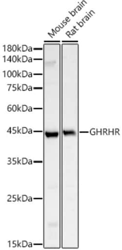 Invitrogen GHRHR Polyclonal Antibody 100 μL; Unconjugated:Antibodies,