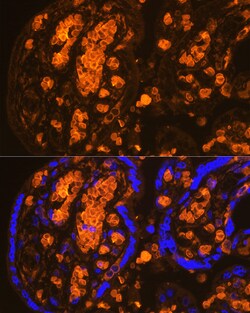 Invitrogen HBA2 Polyclonal Antibody 100 &mu;L; Unconjugated:Antibodies,
