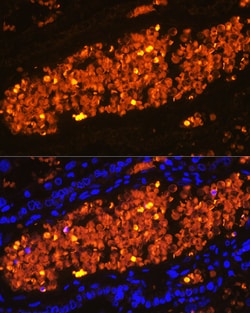 Invitrogen HBA2 Polyclonal Antibody 100 &mu;L; Unconjugated:Antibodies,