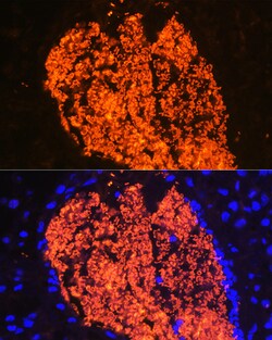 Invitrogen HBA2 Polyclonal Antibody 100 &mu;L; Unconjugated:Antibodies,